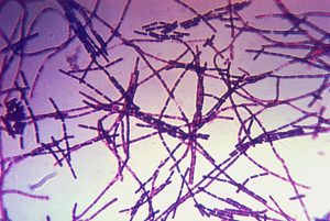 Bacillus Anthracis Gram anthrax